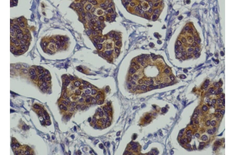 Immunohistochemistry - Anti-RAB27A Antibody (AB0045) - Antibodies.com