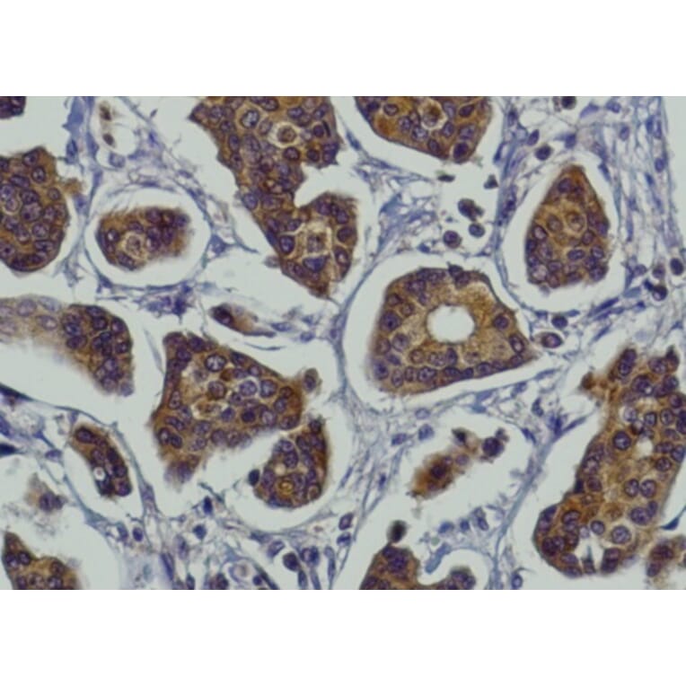 Immunohistochemistry - Anti-RAB27A Antibody (AB0045) - Antibodies.com