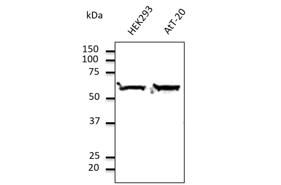 Western Blot - Anti-TUBA4A Antibody (AB0046) - Antibodies.com