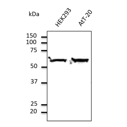 Western Blot - Anti-TUBA4A Antibody (AB0046) - Antibodies.com