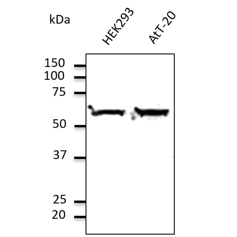 Western Blot - Anti-TUBA4A Antibody (AB0046) - Antibodies.com