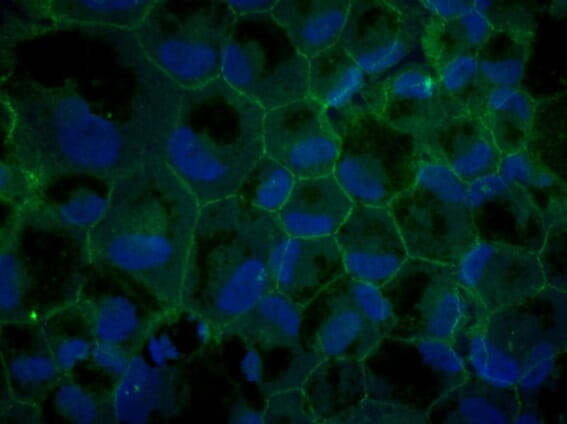 Anti-ZO1 Antibody (A121581) | Antibodies.com