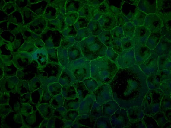 Anti-ZO1 Antibody (A121581) | Antibodies.com