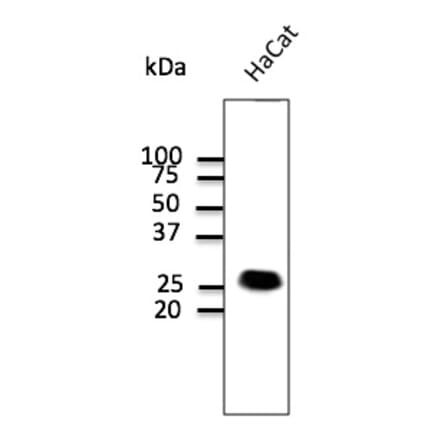 Western Blot - Anti-CAV1 Antibody (AB0055) - Antibodies.com