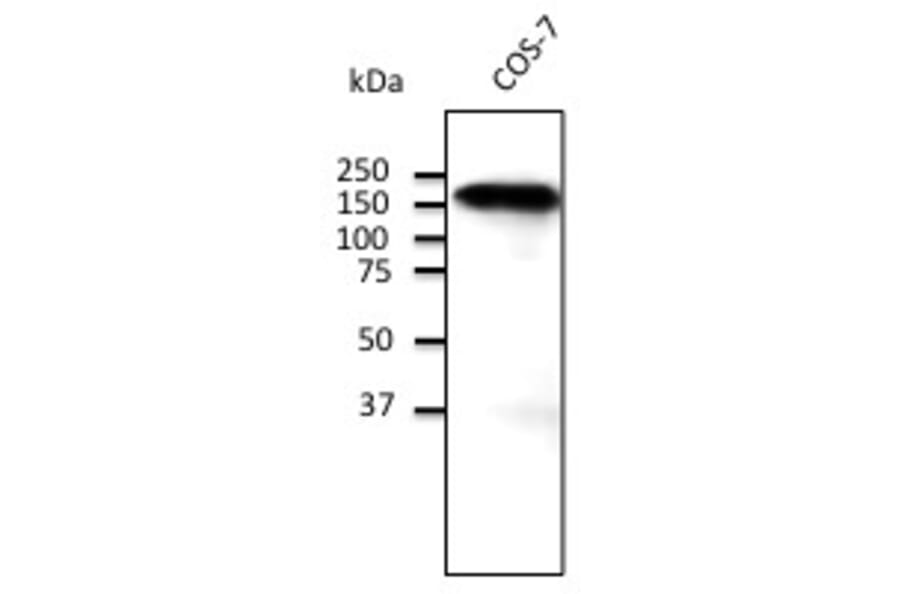 Western Blot - Anti-CDH1 Antibody (A121577) - Antibodies.com