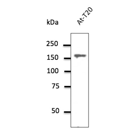 Western Blot - Anti-Clathrin Heavy Chain Antibody (AB0059) - Antibodies.com