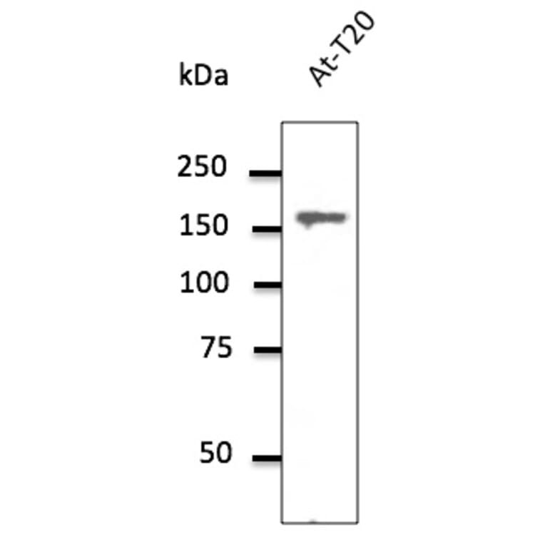 Western Blot - Anti-Clathrin Heavy Chain Antibody (AB0059) - Antibodies.com