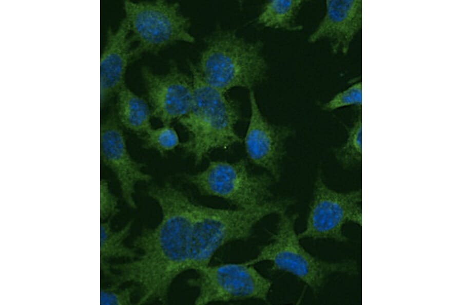 Immunoflouroscence - Anti-Clathrin Heavy Chain Antibody (AB0059) - Antibodies.com
