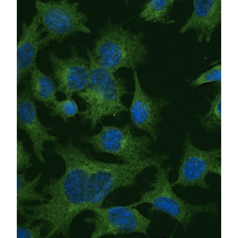 Immunoflouroscence - Anti-Clathrin Heavy Chain Antibody (AB0059) - Antibodies.com