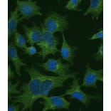 Immunoflouroscence - Anti-Clathrin Heavy Chain Antibody (AB0059) - Antibodies.com