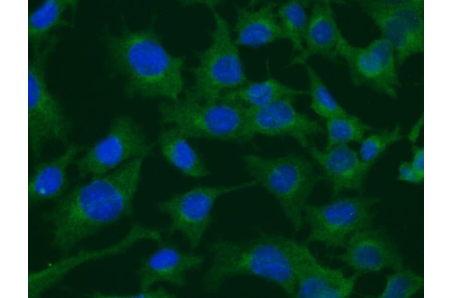 Immunoflouroscence - Anti-Clathrin Heavy Chain Antibody (AB0059) - Antibodies.com