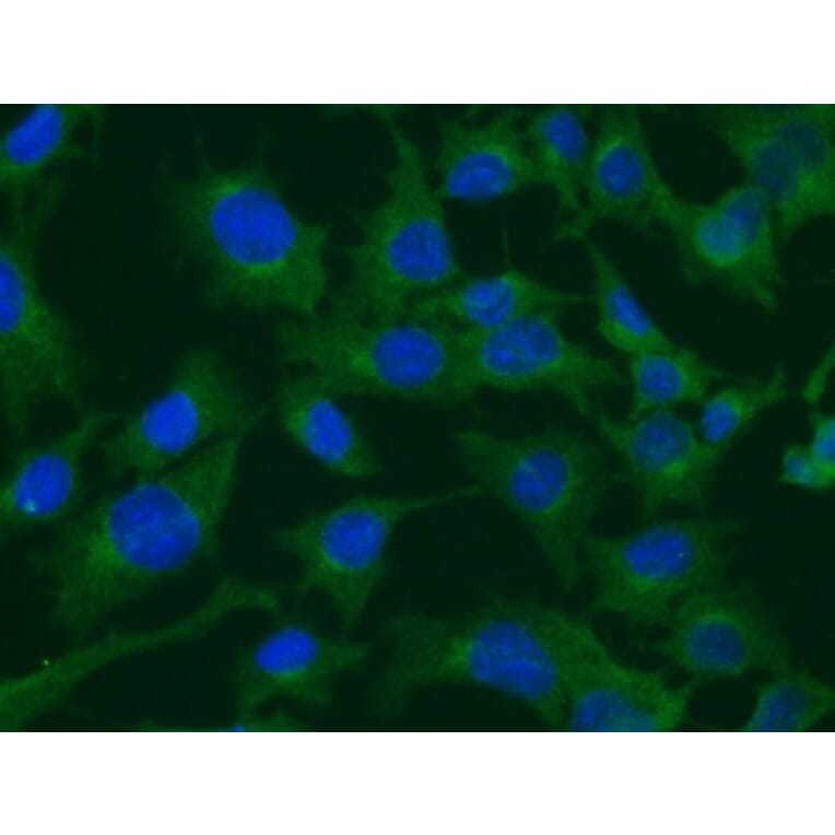 Immunoflouroscence - Anti-Clathrin Heavy Chain Antibody (AB0059) - Antibodies.com