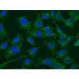 Immunoflouroscence - Anti-Clathrin Heavy Chain Antibody (AB0059) - Antibodies.com