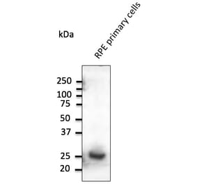 Western Blot - Anti-RAB31 Antibody (AB0068) - Antibodies.com