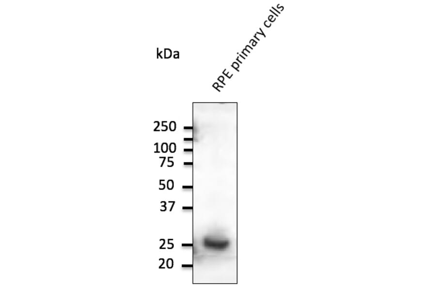 Western Blot - Anti-RAB31 Antibody (AB0068) - Antibodies.com