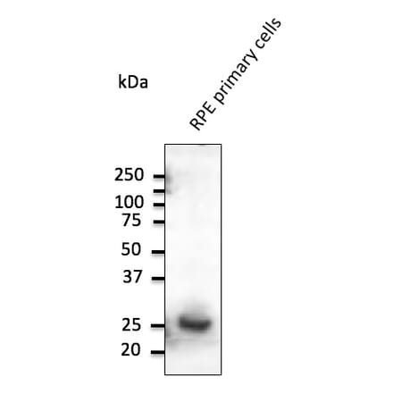 Western Blot - Anti-RAB31 Antibody (AB0068) - Antibodies.com