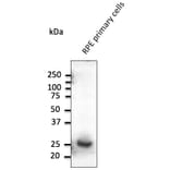 Western Blot - Anti-RAB31 Antibody (AB0068) - Antibodies.com