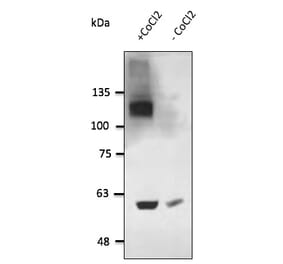 Western Blot - Anti-HIF-1 alpha Antibody (AB0070) - Antibodies.com
