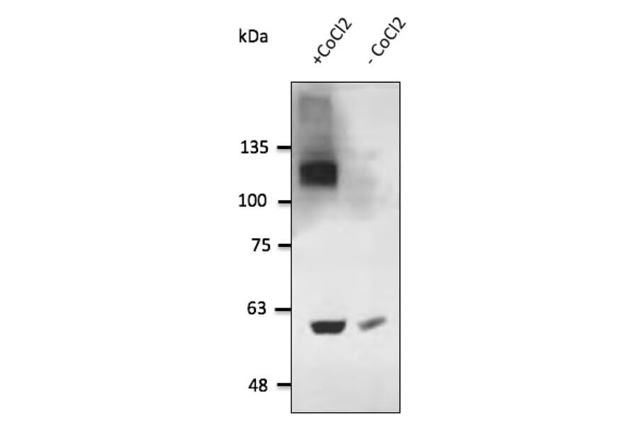 Western Blot - Anti-HIF-1 alpha Antibody (AB0070) - Antibodies.com