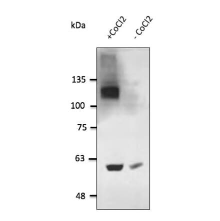 Western Blot - Anti-HIF-1 alpha Antibody (AB0070) - Antibodies.com
