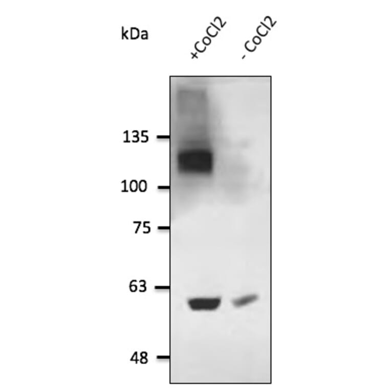 Western Blot - Anti-HIF-1 alpha Antibody (AB0070) - Antibodies.com