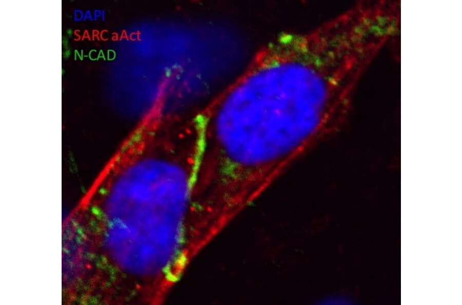 Immunoflouroscence - Anti-N Cadherin Antibody (AB0071) - Antibodies.com
