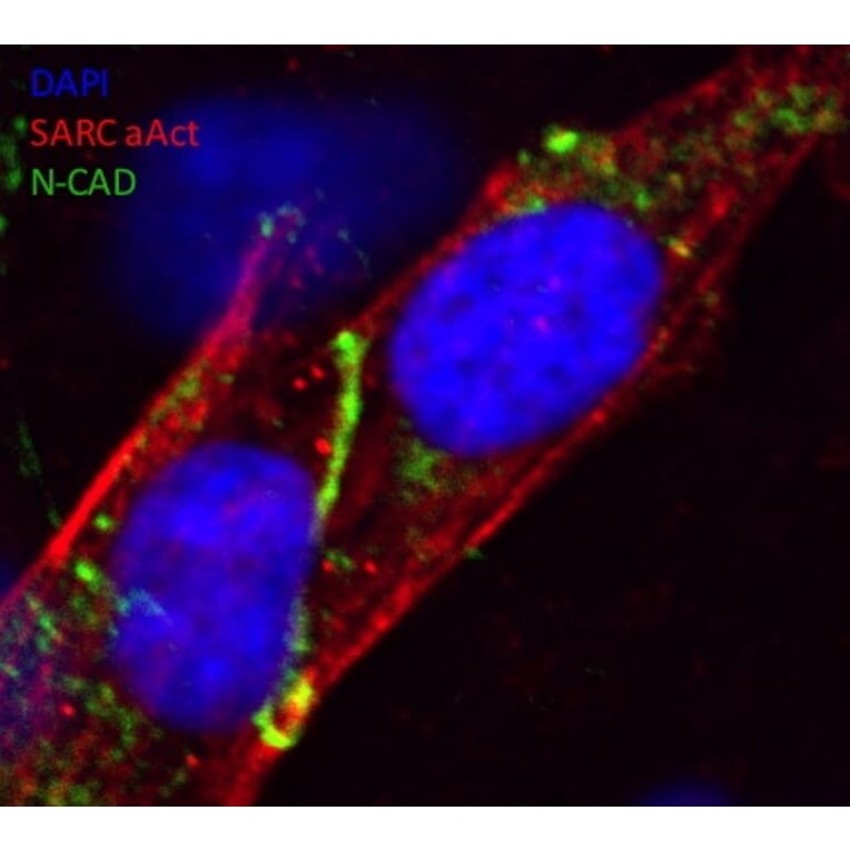 Immunoflouroscence - Anti-N Cadherin Antibody (AB0071) - Antibodies.com