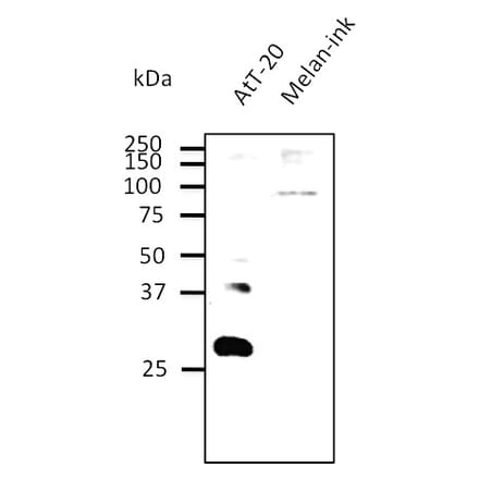 Western Blot - Anti-RAB27B Antibody (AB0072) - Antibodies.com