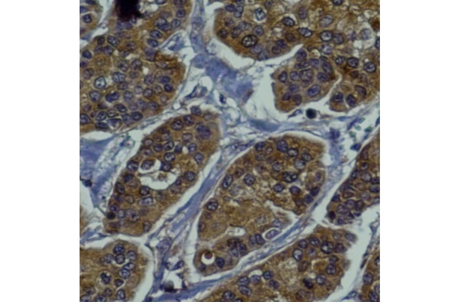 Immunohistochemistry - Anti-RAB27B Antibody (AB0072) - Antibodies.com