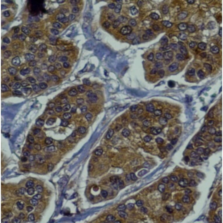 Immunohistochemistry - Anti-RAB27B Antibody (AB0072) - Antibodies.com