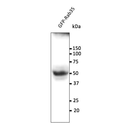Western Blot - Anti-RAB35 Antibody (AB0073) - Antibodies.com