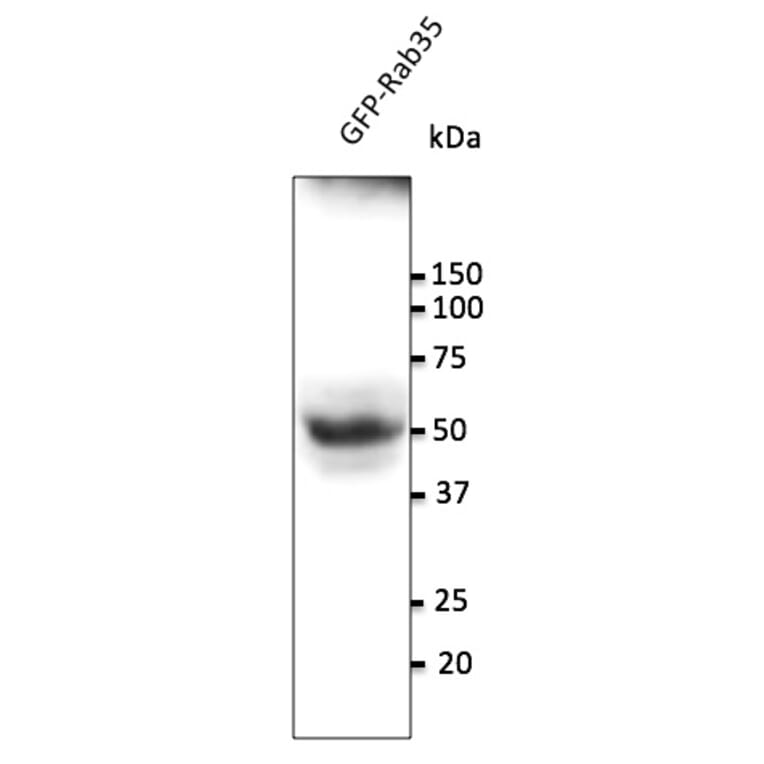 Western Blot - Anti-RAB35 Antibody (AB0073) - Antibodies.com