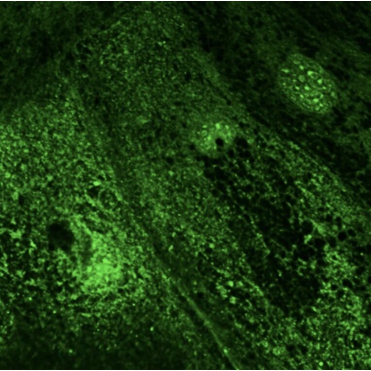 Immunoflouroscence - Anti-RAB28 Antibody (AB0075) - Antibodies.com