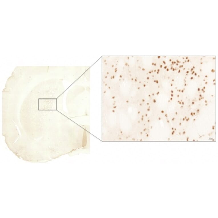 Immunohistochemistry - Anti-Huntingtin Antibody (AB0080) - Antibodies.com