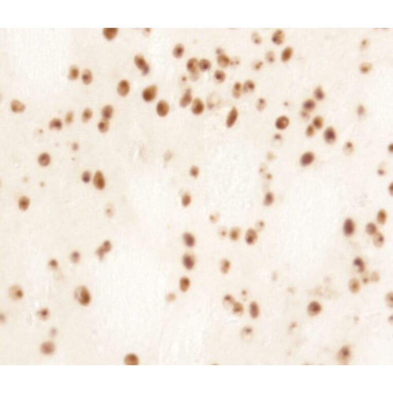 Immunohistochemistry - Anti-Huntingtin Antibody (AB0080) - Antibodies.com