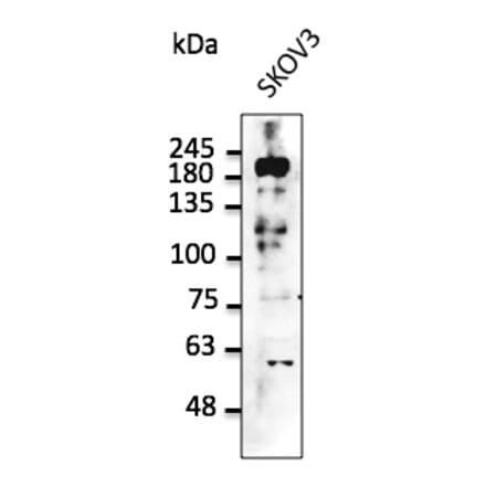 Western Blot - Anti-ERBB2 Antibody (AB0088) - Antibodies.com
