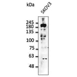 Western Blot - Anti-ERBB2 Antibody (AB0088) - Antibodies.com