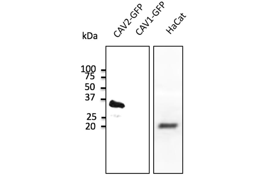 Western Blot - Anti-CAV2 Antibody (AB0094) - Antibodies.com
