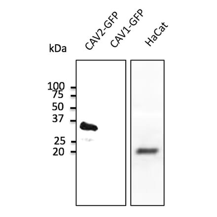 Western Blot - Anti-CAV2 Antibody (AB0094) - Antibodies.com