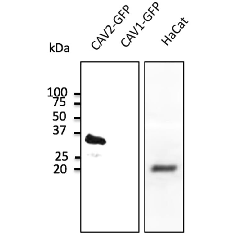 Western Blot - Anti-CAV2 Antibody (AB0094) - Antibodies.com