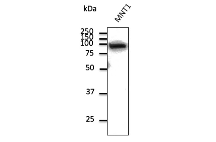 Western Blot - Anti-beta Catenin Antibody (AB0095) - Antibodies.com