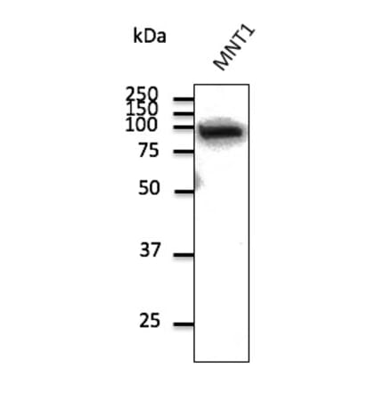 Western Blot - Anti-beta Catenin Antibody (AB0095) - Antibodies.com