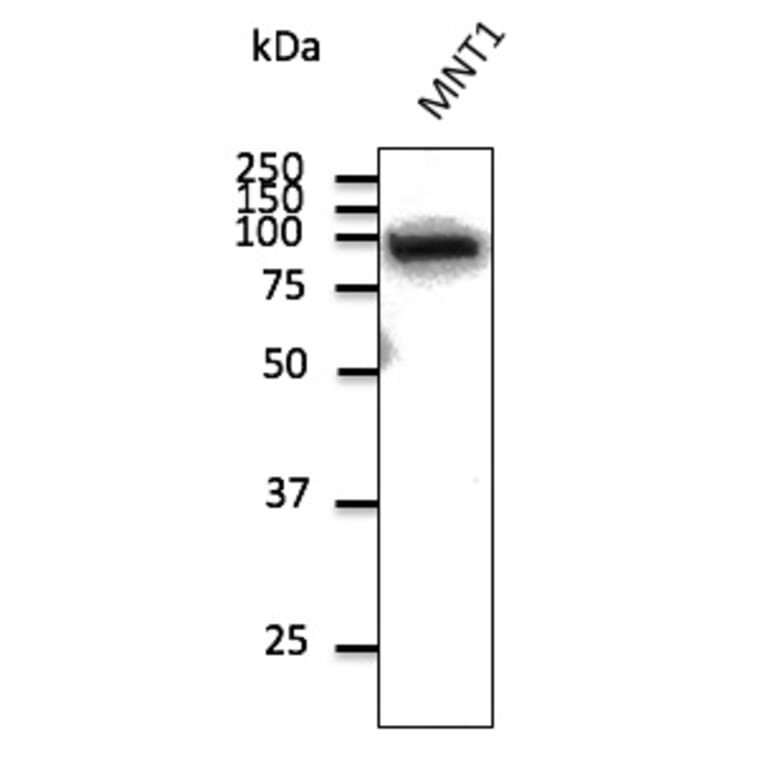 Western Blot - Anti-beta Catenin Antibody (AB0095) - Antibodies.com