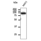 Western Blot - Anti-beta Catenin Antibody (AB0095) - Antibodies.com