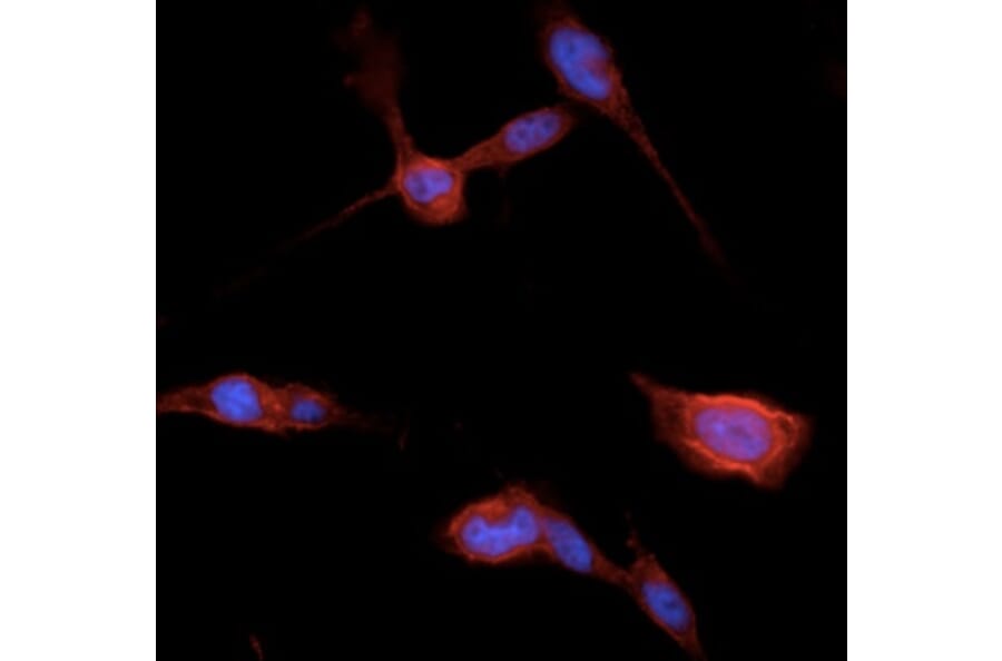 Immunoflouroscence - Anti-beta Catenin Antibody (AB0095) - Antibodies.com