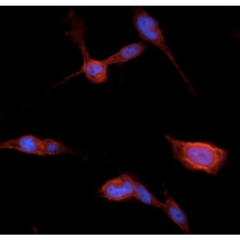 Immunoflouroscence - Anti-beta Catenin Antibody (AB0095) - Antibodies.com