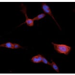 Immunoflouroscence - Anti-beta Catenin Antibody (AB0095) - Antibodies.com