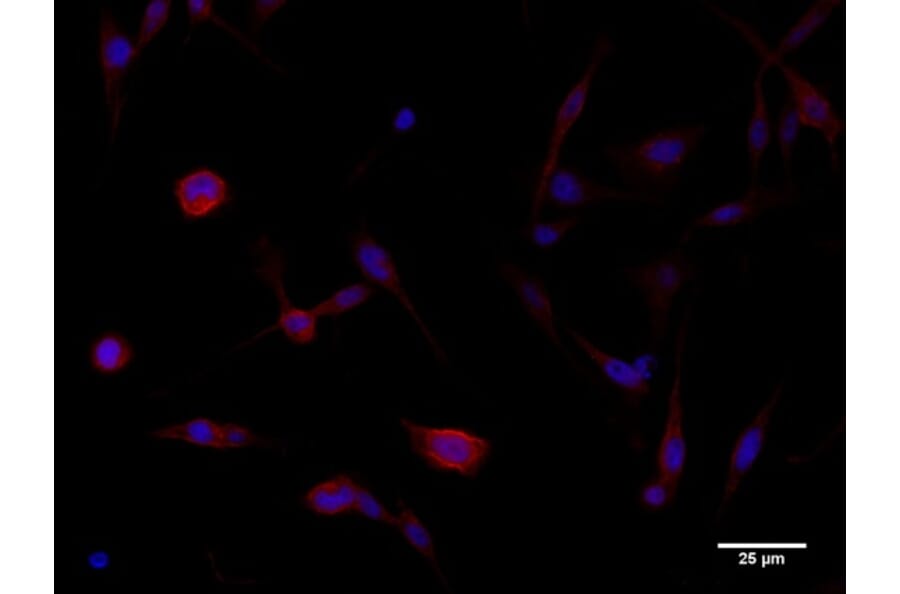 Immunoflouroscence - Anti-beta Catenin Antibody (AB0095) - Antibodies.com