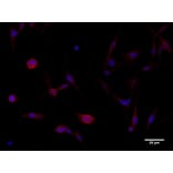 Immunoflouroscence - Anti-beta Catenin Antibody (AB0095) - Antibodies.com