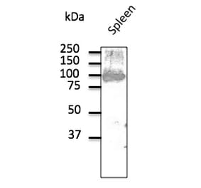 Western Blot - Anti-CD19 Antibody (AB0097) - Antibodies.com
